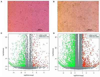 Genome-Wide Analysis of Long Noncoding RNA Profiles in Seneca Valley Virus–Infected PK15 Cells